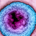 Understanding Vaccines to Prevent Herpes