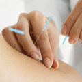 The Benefits of Acupuncture: An Alternative Therapy for Herpes Remedies