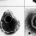 Everything You Need to Know About Blood Tests for Genital Herpes Diagnosis