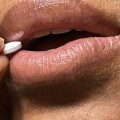 Using Antiviral Medications to Prevent Oral Herpes