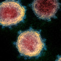 Understanding Contact with an Infected Person's Saliva or Skin