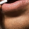 Kissing Someone With Oral Herpes