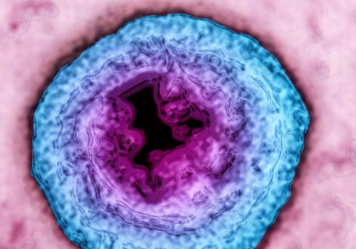 Understanding Vaccines to Prevent Herpes