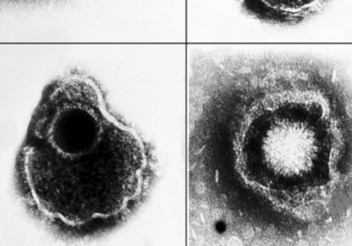 Everything You Need to Know About Blood Tests for Genital Herpes Diagnosis