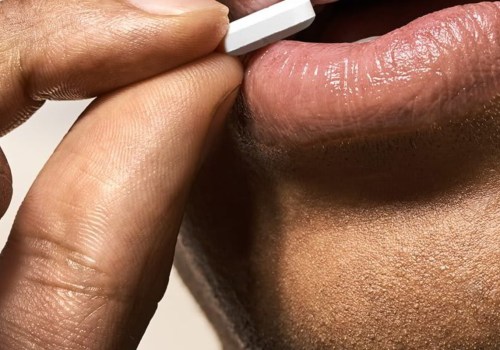 Kissing Someone With Oral Herpes
